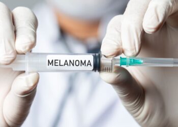 New mRNA Vaccine Reduces Risk variation of Melanoma Recurrence by Over 40 Percent