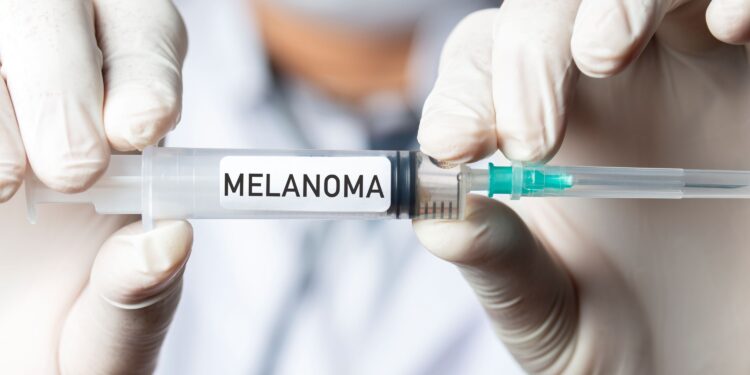 New mRNA Vaccine Reduces Risk variation of Melanoma Recurrence by Over 40 Percent
